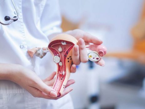Θεραπεία ινομυωμάτων μήτρας